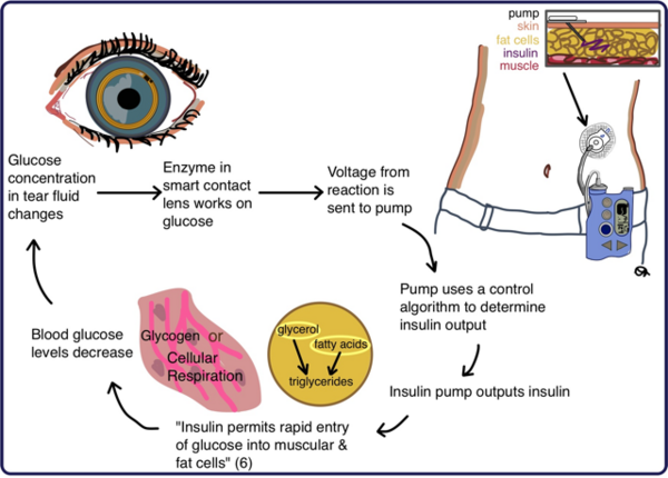 The Clinical Accuracy of Non-Invasive Glucose Monitoring for <i>ex vivo</i> Artificial Pancreas