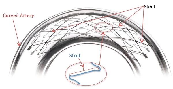 Comparing the Effect of Stent Geometry on Blood Flow Rate of Curved Coronary Artery Stenosis