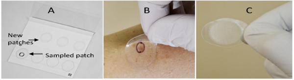 Characterization of Inflammatory Cytokine Gene Expression in a Family with a History of Psoriasis