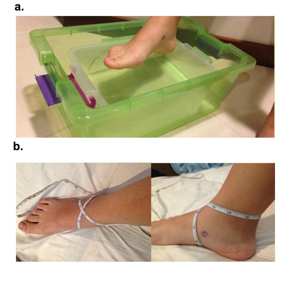 Comparing the Effectiveness of Popular Treatments for Swelling and Scarring