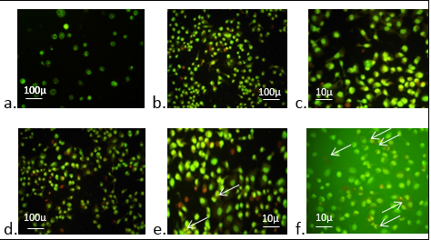 A study to determine the anti-cancer and pro-apoptotic properties of Amaranthus spinosus Linn. Extract, AS20 
