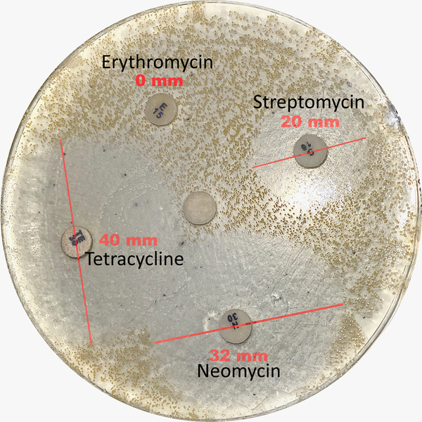 Effects of Prolonged Azithromycin Therapy on Bacterial Resistance to Functionally Analogous Antibiotics