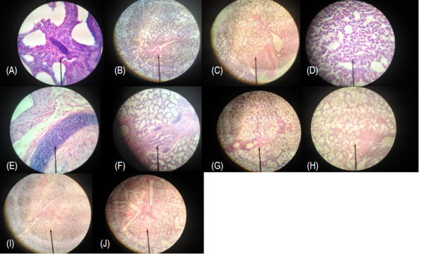 Identification of a Free Radical Scavenger as an Additive for Lung Transplant Preservation Solution to Inhibit Coagulative Necrosis and Extend Organ Preservation