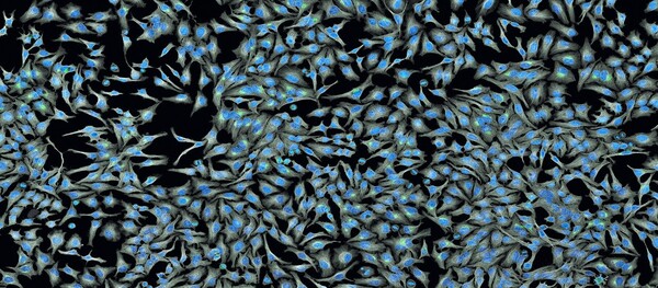 Phytochemical analysis of <em>Annona Reticulata</em> extract and an <em>in-vitro</em> study on its anti-proliferative effects