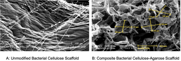 Developing “Off the Shelf” Pancreases for Diabetic Patients Using Bacterial and Kombucha Tea Waste 