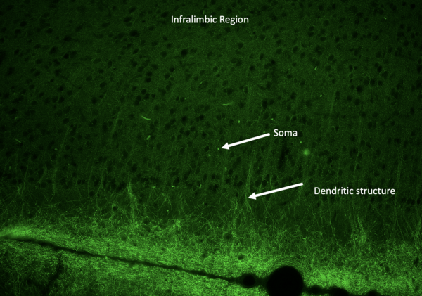 Testing HCN1 channel dysregulation in the prefrontal cortex using a novel piezoelectric silk neuromodulator