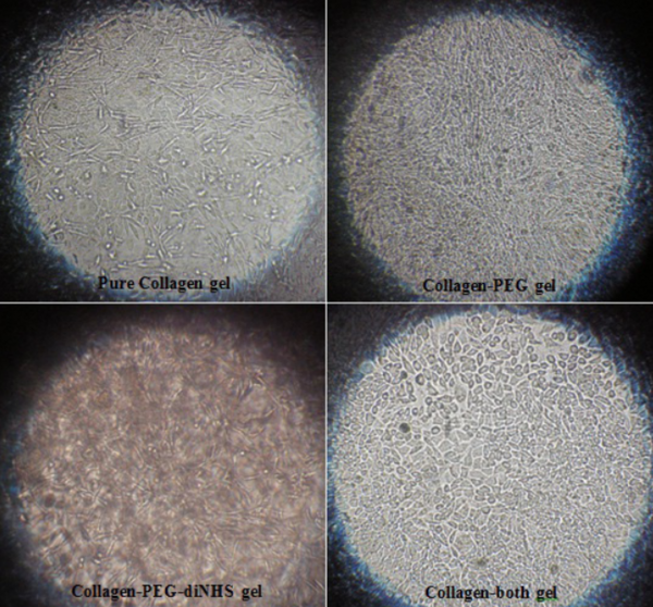 Effect of Collagen Gel Structure on Fibroblast Phenotype
