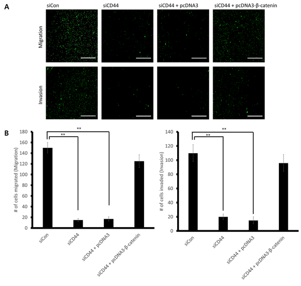 Down-regulation of CD44 inhibits Wnt/β-catenin mediated cancer cell migration and invasion  in gastric cancer