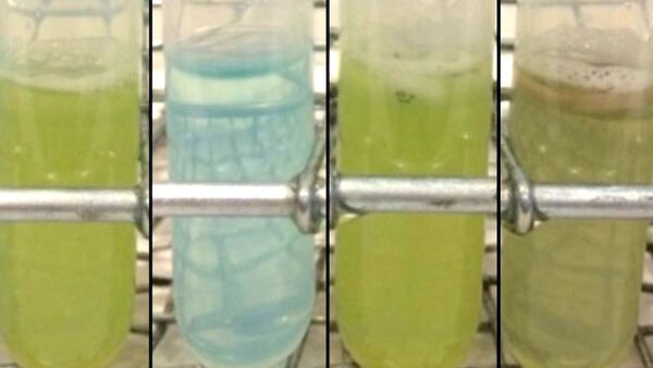 The Effects of Antibiotics on Nutrient Digestion