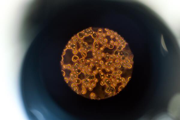 The role of CYP46A1 and its metabolic product, 24S-hydroxycholesterol, in Neuro 2A cell death