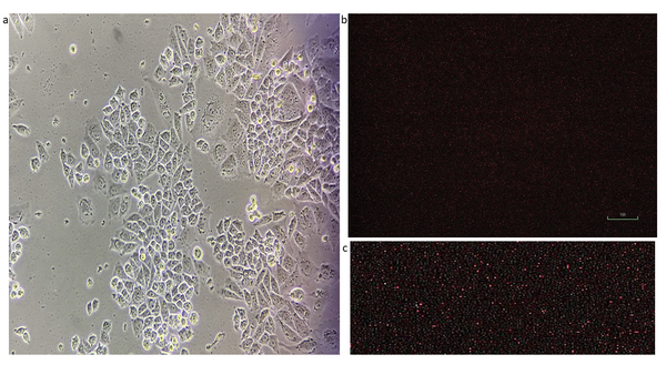 Manipulation of extracellular matrix mechanical cues to stimulate oligodendrocytes to promote remyelination