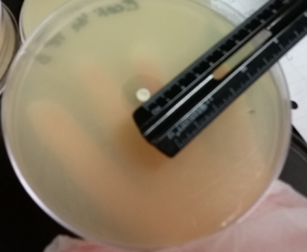 Talinum paniculatum root exhibits synergistic antimicrobial activity with Tetracycline, Erythromycin, and Streptomycin against S. aureus but has no observed effect on antibiotic efficacy against E. coli