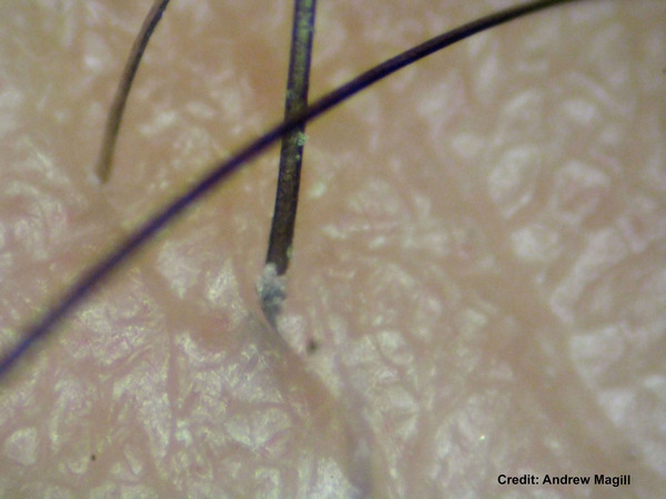 The Potential of Fibroblast Growth Factors to Stimulate Hair Growth In Vitro