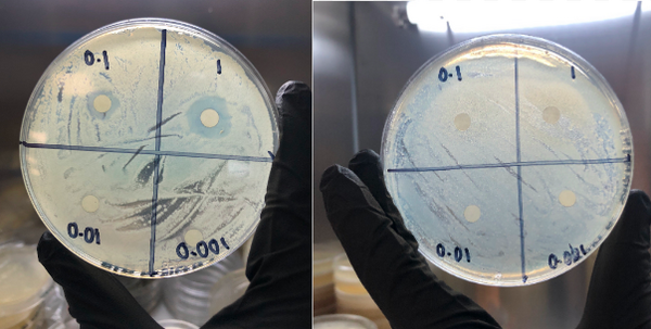 Strain-selective <i>in vitro</i> and <i>in silico</i> structure activity relationship (SAR) of N-acyl β-lactam broad spectrum antibiotics
