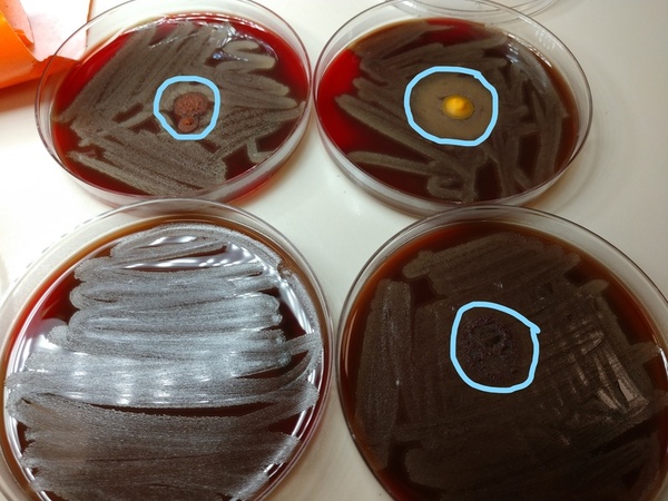 Are alkaline spices the future of antibiotics?