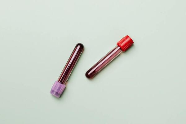 Evaluation of platelet-rich plasma vs. platelet lysate: VEGF and PDGF concentration, stability, and shelf life