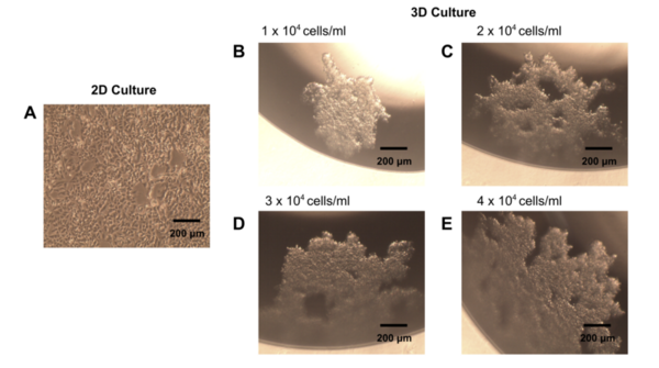 Phospholipase A2 increases the sensitivity of doxorubicin induced cell death in 3D breast cancer cell models