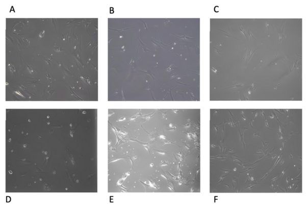 A comparison study in the expansion of human bone marrow mesenchymal stem cells