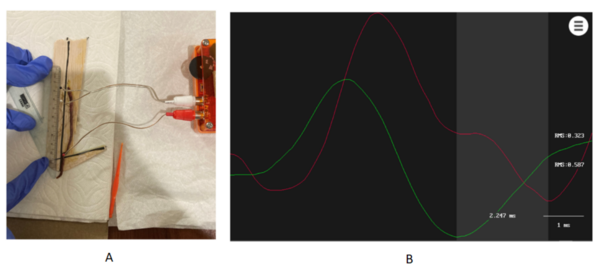 Effects of <em>Withania Somnifera</em> on Charcot-Marie-Tooth Disease Type 1A in the model organism <em>Eisenia Fetida</em>