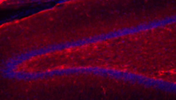 Characterizing the association between hippocampal reactive astrogliosis, anhedonia-like behaviors, and neurogenesis in a monkey model of stress and antidepressant treatment