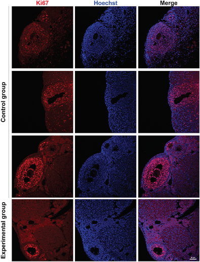 Autologous transplantation of fresh ovarian tissue in the ICR mice model