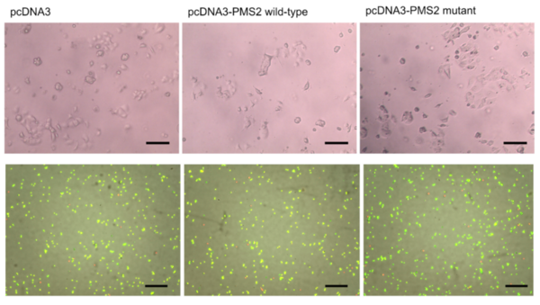 The novel function of <em>PMS2</em> mutation on ovarian cancer proliferation
