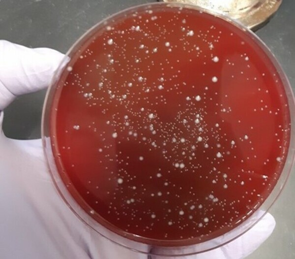 Pediatric probiotic culture survival study in acidic pH using an <em>in vitro</em> model