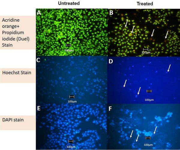 Cell cytotoxicity and pro-apoptosis on MCF-7  cells using polyherbal formulation, MAT20
