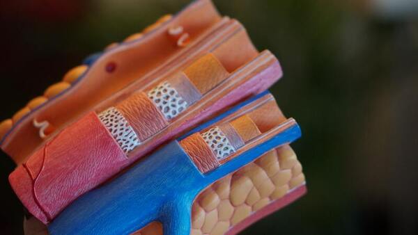 Deciphering correlation and causation in risk factors for heart disease with Mendelian randomization