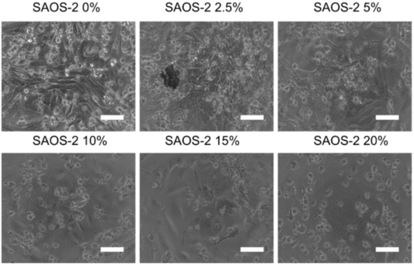Development of anti-cancer bionanoparticles isolated from corn for bone cancer treatment