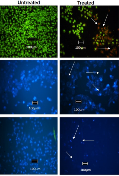 Cytotoxicity evaluation of <i>Amaranthus</i> extracts compared with AS20 on MCF-7 cancer cells