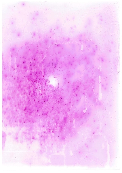 The Relationship Between Close-Range Shooting Distance and Nitrite Patterns on Cotton and Polyester Clothing