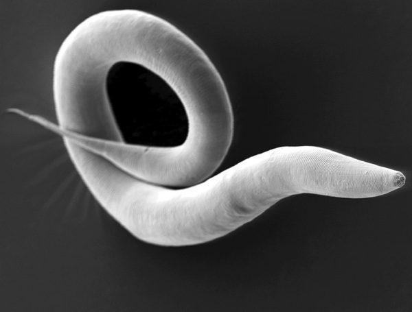 Impact of daf-25 and daf-11 Mutations on Olfactory Function in C. elegans