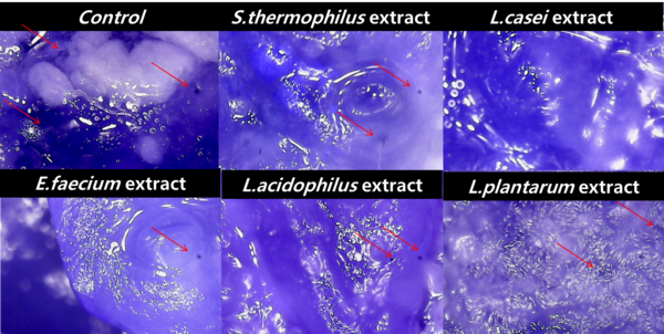 The Inhibitory Effect of Probiotics on the Growth and Biofilm Formation of Salmonella Sp.  