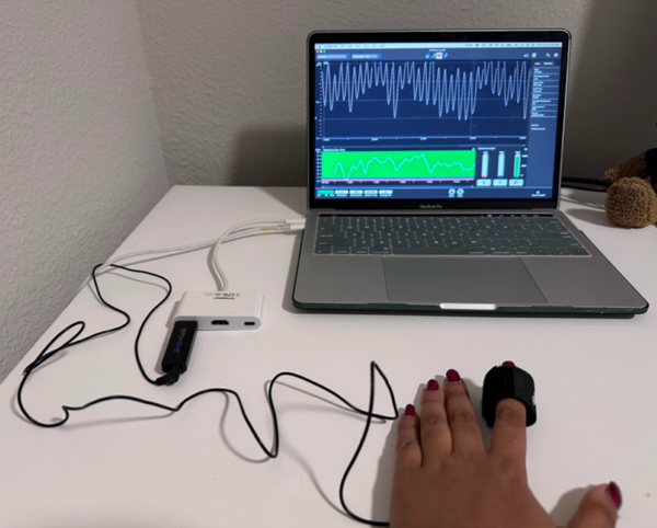 Investigating the impact of electrocardiography biofeedback on POTS symptom management
