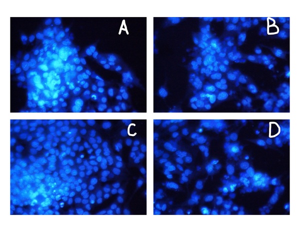 Cytokine Treatment for Myocarditis May Directly Impact Cardiomyocytes Negatively