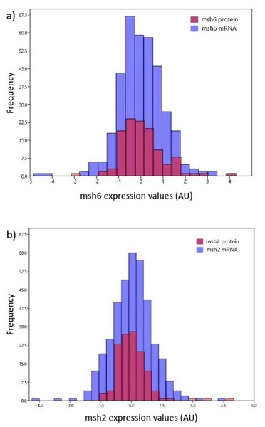 Mismatch repair is not correlated with genomic alterations in glioblastoma patients