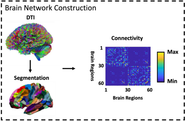 Predictions of neural control deficits in elders with subjective memory complaints and Alzheimer’s disease