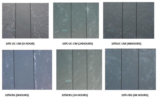 Unveiling the wound healing potential of umbilical cord derived conditioned medium: an <em>in vitro</em> study