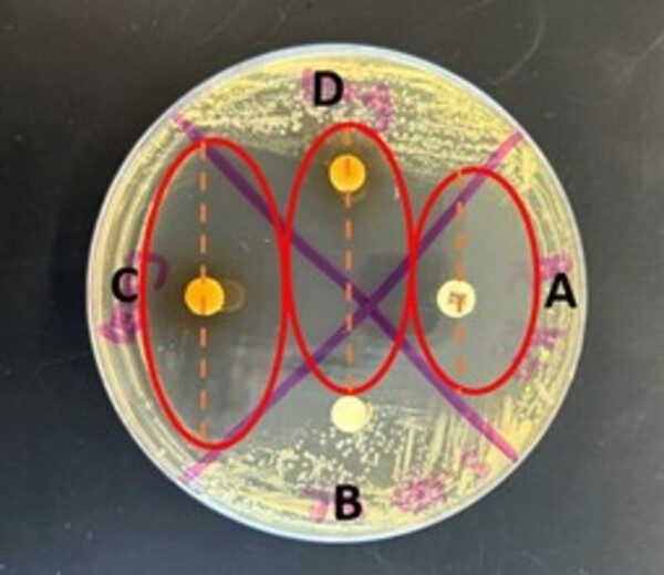 Star anise and oregano essential oil: A comparative evaluation of antibacterial effect
