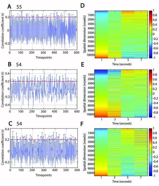 Studying the effects of different anesthetics on quasi-periodic patterns in rat fMRI