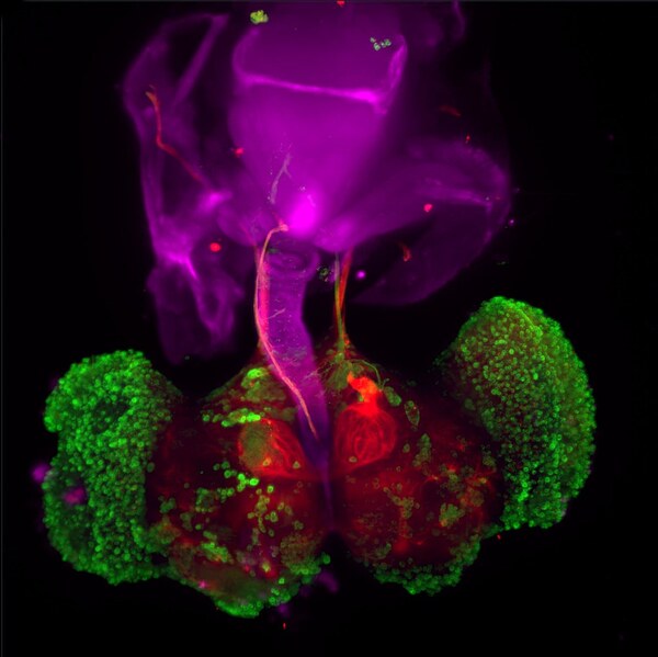 Development of a Novel Treatment Strategy to Treat Parkinsonian Neurodegeneration by Targeting Both Lewy Body Aggregation and Dopaminergic Neuronal Degradation in a <em>Drosophila melanogaster</em> Model