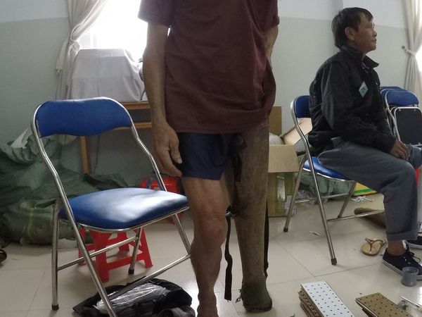 The Effects of Vibrotactile Feedback on Task Performance in a 3D-printed Myoelectric Prosthetic Arm