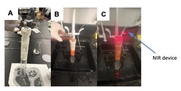 Near-infrared activation of environmentally-friendly gold and silver nanoparticles for unclogging arteries 