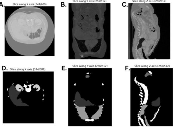 Unlocking robotic potential through modern organ segmentation
