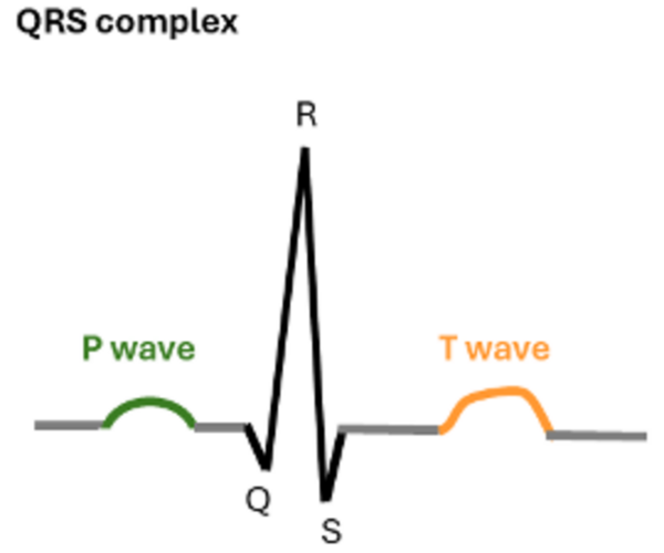 Tree-Based Learning Algorithms to Classify ECG with Arrhythmias