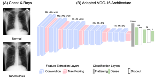 Effects of data amount and variation in deep learning-based tuberculosis diagnosis in chest X-ray scans
