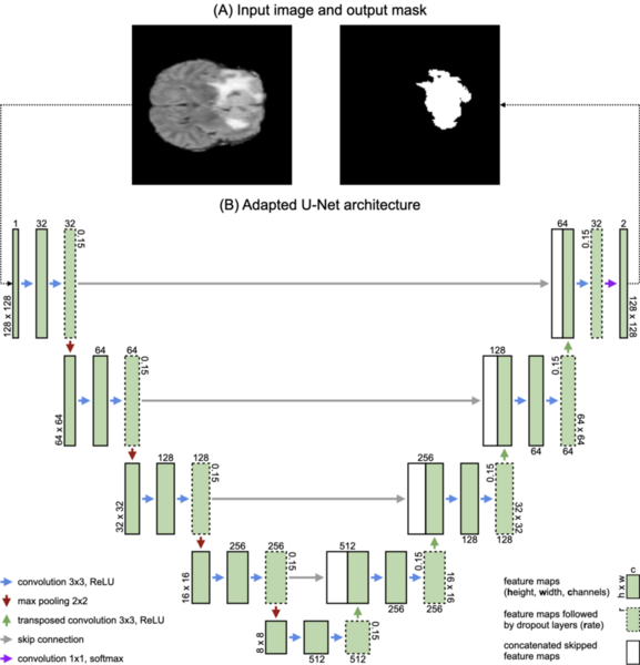 Advancements in glioma segmentation: comparing the U-Net and DeconvNet models