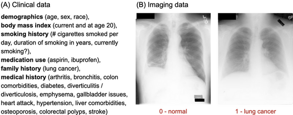 Lung cancer AI-based diagnosis through multi-modal integration of clinical and imaging data