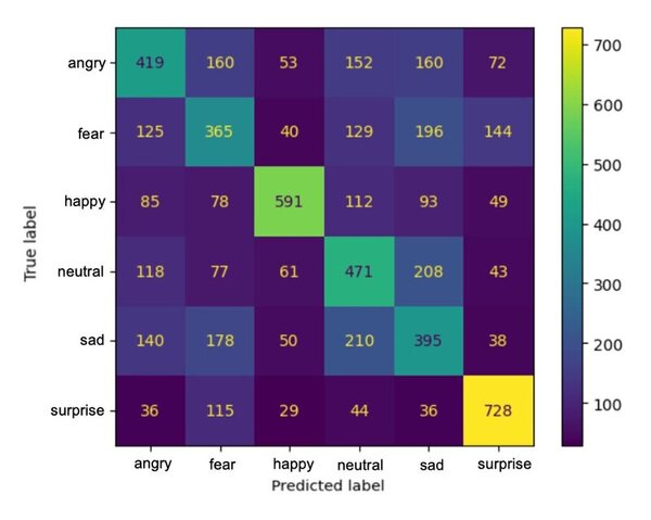 Identifying anxiety and burnout from students facial expressions and demographics using machine learning